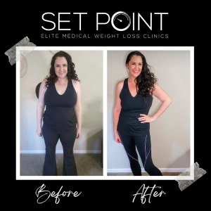 Before & After Gallery of Set Point Medical Weight Loss Clinic