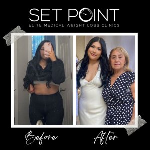 Before & After Gallery of Set Point Medical Weight Loss Clinic