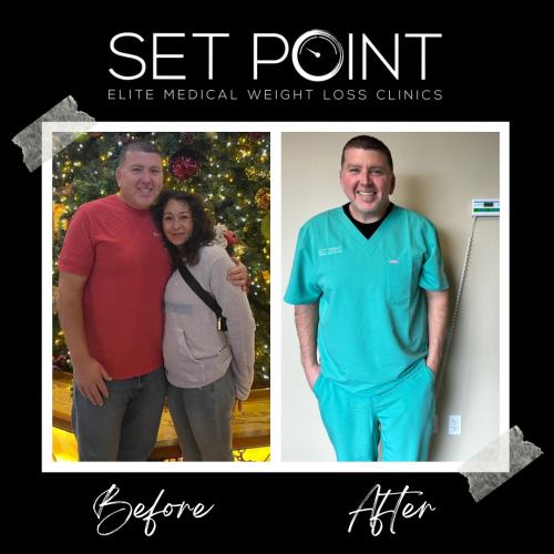 Before & After Gallery of Set Point Medical Weight Loss Clinic