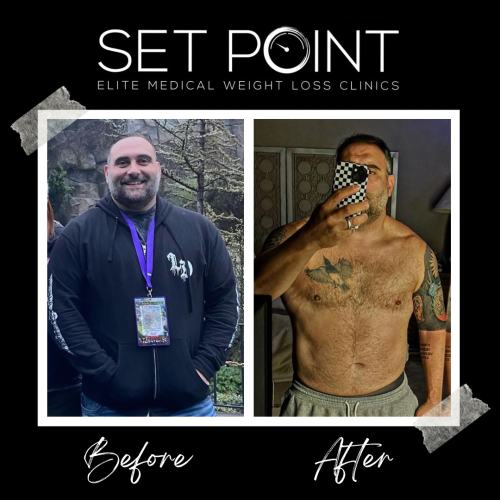 Before & After Gallery of Set Point Medical Weight Loss Clinic